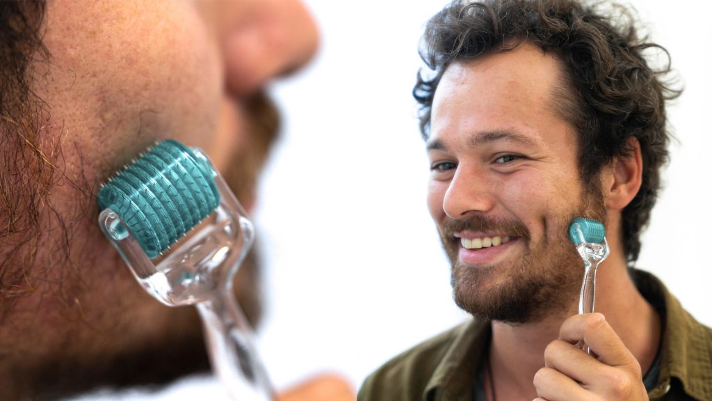 A man uses a dermaroller for hair, hair rollers