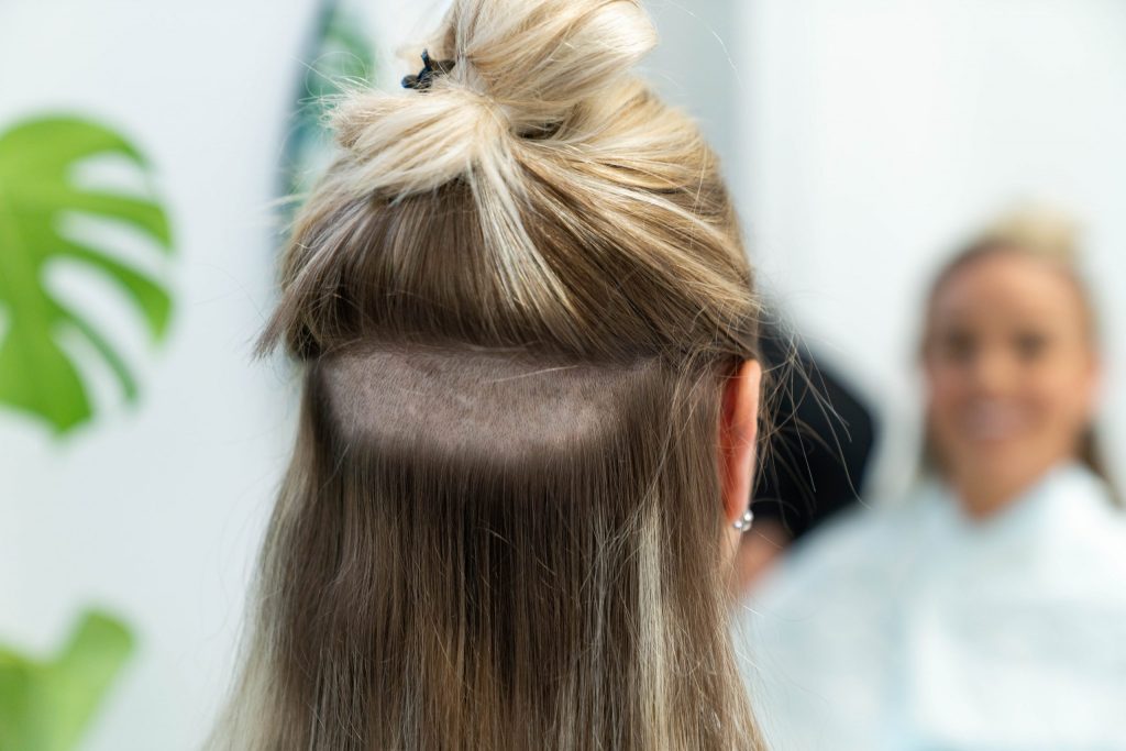 kvinne med donorområde barbert