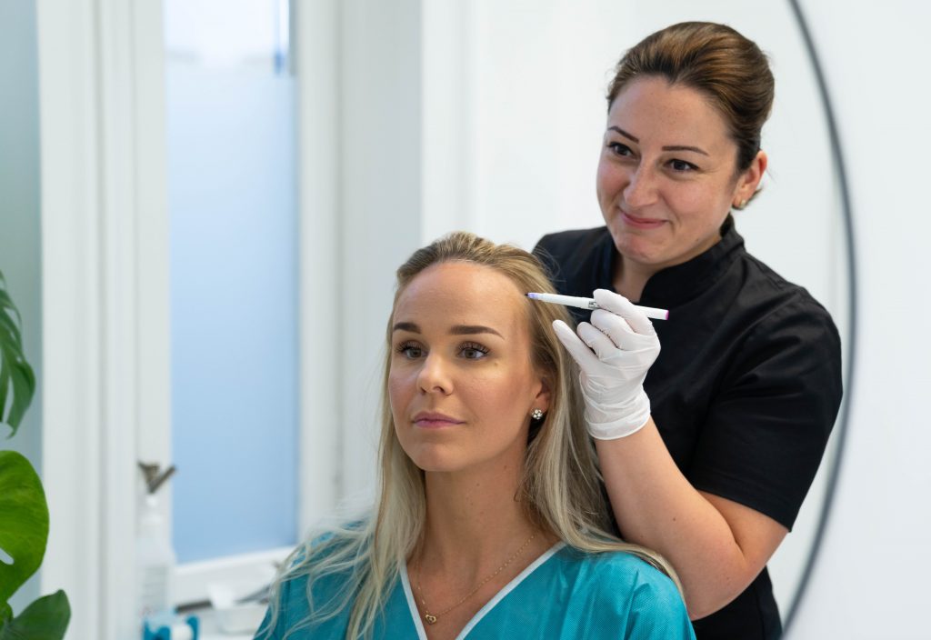 Tegning af hårgrænse før hårtransplantation