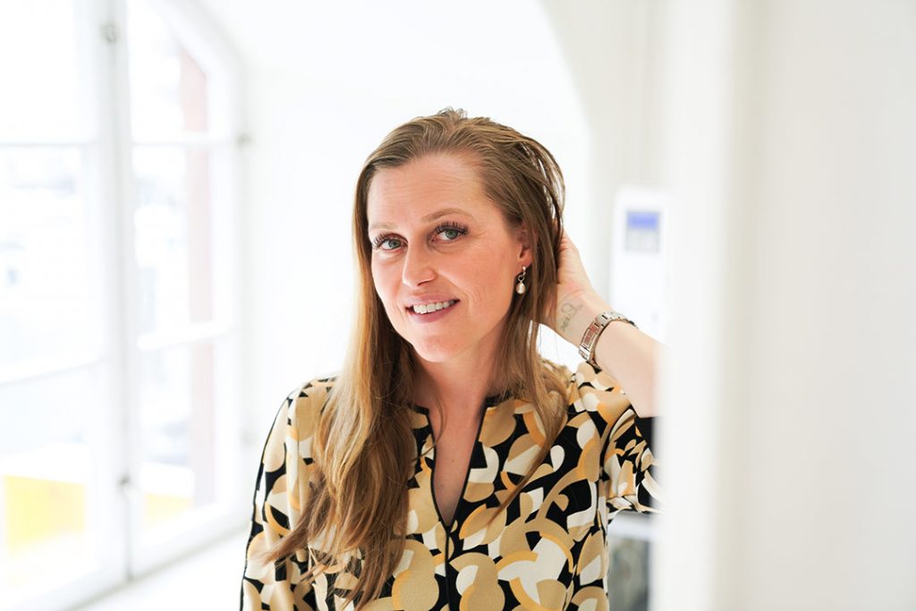 En kvinde efter hårtransplantation