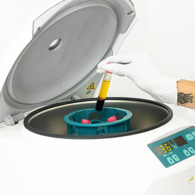 blodplasman lägga in i en centrifug