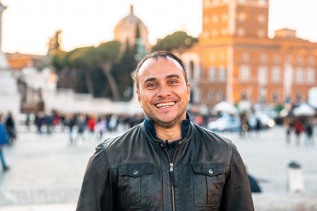 massimo fortæller om sin hårtransplantation