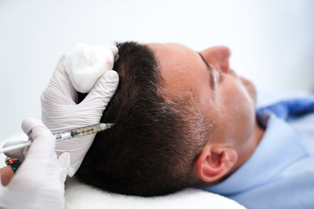 en mann gjennomgår en prp-behandling