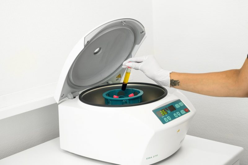 En kvinna stoppar i blodplasma i en centrifug