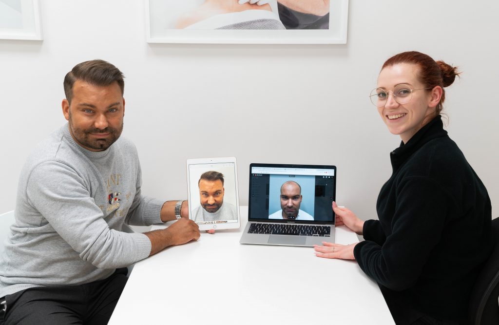 En mand med DHT får en hårkur